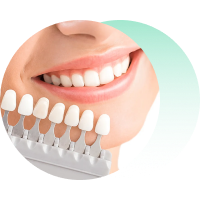 Имплантация зубов “под ключ” (ST)