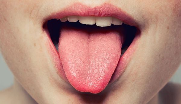 Почему покалывает язык и как с этим справиться?