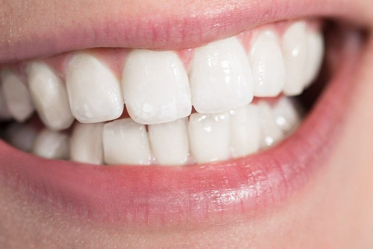 Как укрепить эмаль зубов?