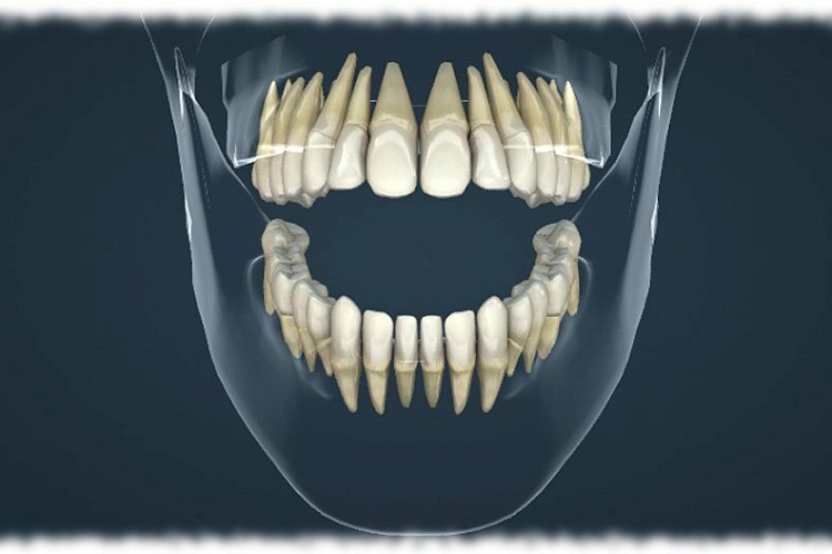 Улыбка под номером: Как стоматологи переводят улыбки на свой язык нумерации